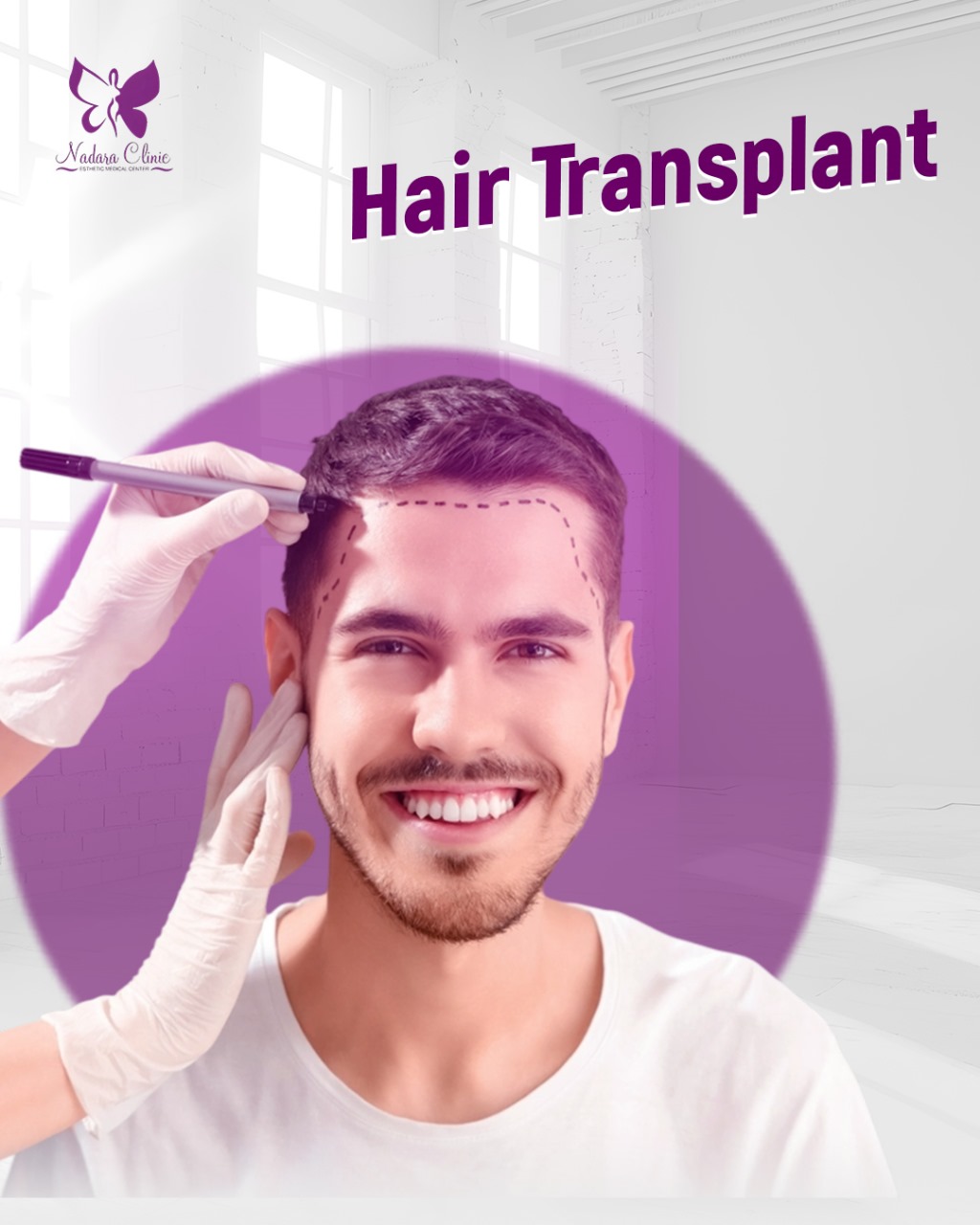 Hair Transplant